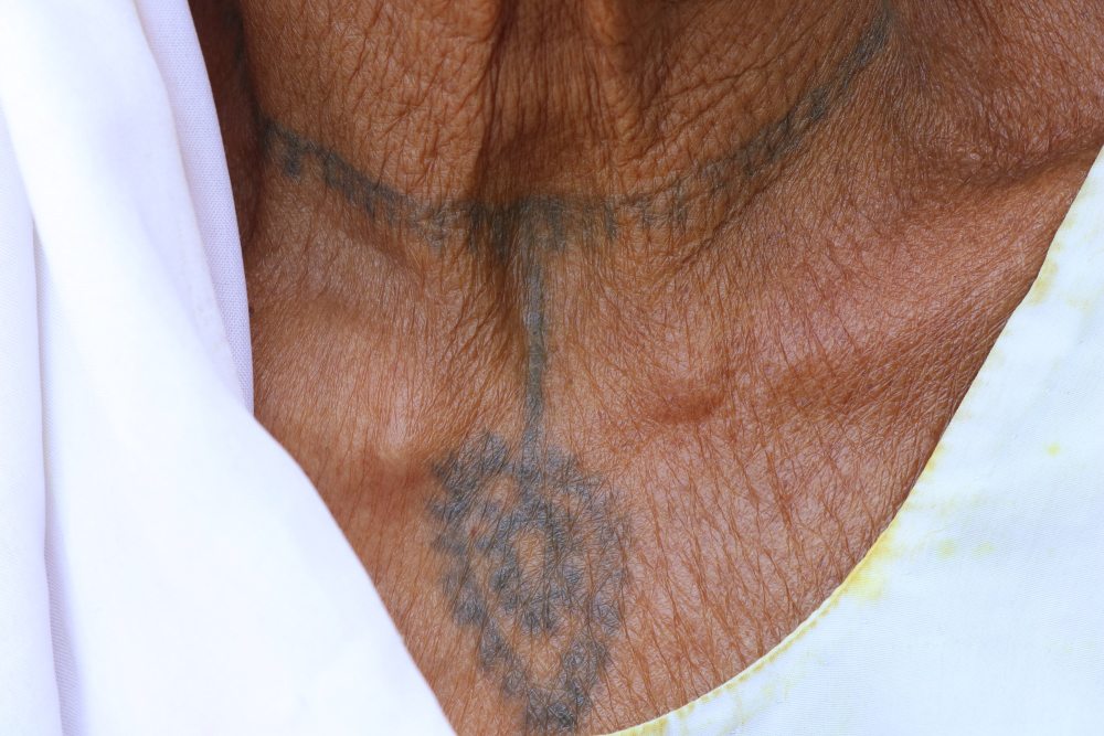 A woman with godna on her neck